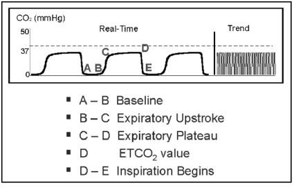 Capnography Monitoring Anesthesia School, Paramedic School, Medical Mnemonics, Brain Book, Medical Tech, Mechanical Ventilation, Emt Paramedic, Emergency Medical Technician, Vet School