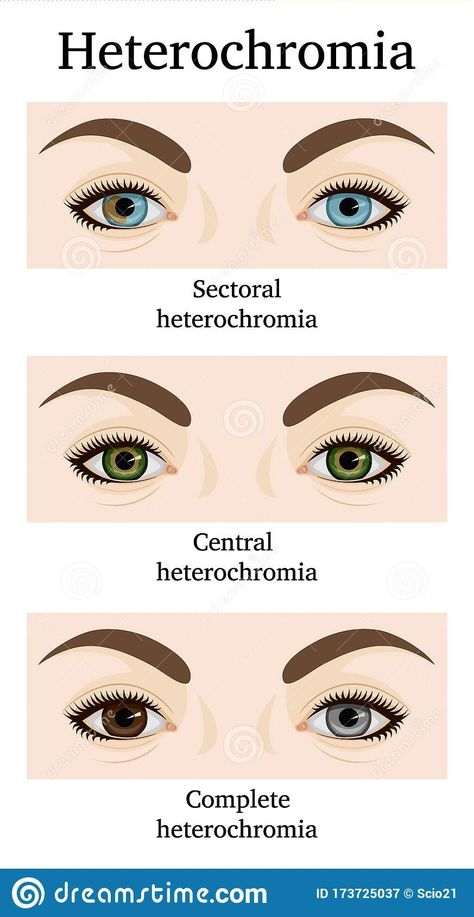 Sectoral Heterochromia, Central Heterochromia, Heterochromia Eyes, How To Draw Eyelashes, Hazel Green Eyes, Aesthetic Eyes, Eye Design, Pretty Eyes, Character Design References