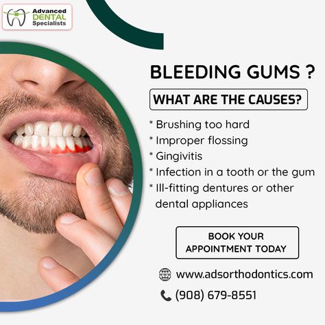 Do you know what are the causes of bleeding gums? Dental Posters Ideas, Dental Awareness Posters, Dentist Advertising, Dental Post, Dental Poster, Dental Ideas, Logistics Design, Dental Advertising, Gum Surgery