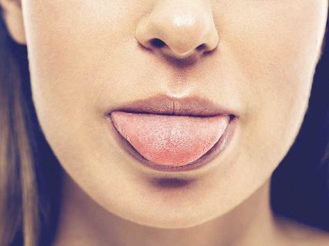 What’s Causing a Sweet Taste in My Mouth? Sweet Taste In Mouth, Bad Taste In Mouth, Metallic Taste In Mouth, Remedies For Dry Mouth, Tongue Health, Dry Mouth, Life Wisdom, Healthy Lifestyle Habits, Receding Gums