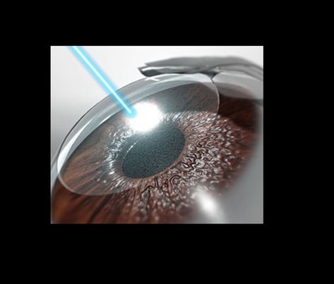 If you are also one of those, then the 100% satisfactory Lasik Eye Surgery in Virar is one of the best options for you. https://www.evernote.com/shard/s644/sh/563adfe3-154a-bcf3-765c-d1b52bc98f85/81e8d3efffeaa3890bab4aa8db338cdc Lasik Eye Surgery, Eye Care Center, Laser Vision, Laser Eye Surgery, Lasik Surgery, Parts Of The Eye, Laser Eye, Laser Surgery, Eye Center