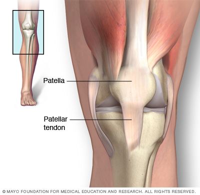 Patellar tendinitis causes pain in the patellar tendon, which runs from the kneecap (patella) to the shinbone (tibia). Kt Tape Peroneal Tendon, Patella Tendon Stretches, Tendon Satori, Tendon Vs Ligament, Common Knee Injuries, Patellar Tendon, Knee Health, Human Cells, Knee Strengthening