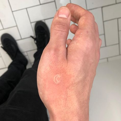 White Ink Moon Tattoo, Poke And Stick Tattoo, Stick N Poke Ideas, Stick Poke, Stick Tattoo, Stick Poke Tattoo, Tattoo White, Stick N Poke, Sharpie Tattoos