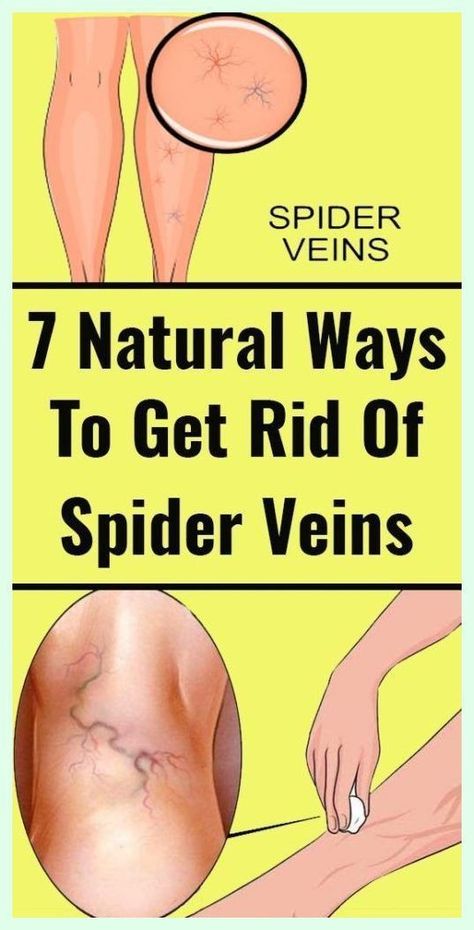 Home Remedies For Spiders, Get Rid Of Spiders, School Communication, Creating A Newsletter, Abdominal Exercises, Natural Healing, Holistic Health, Back Pain, Pain Relief