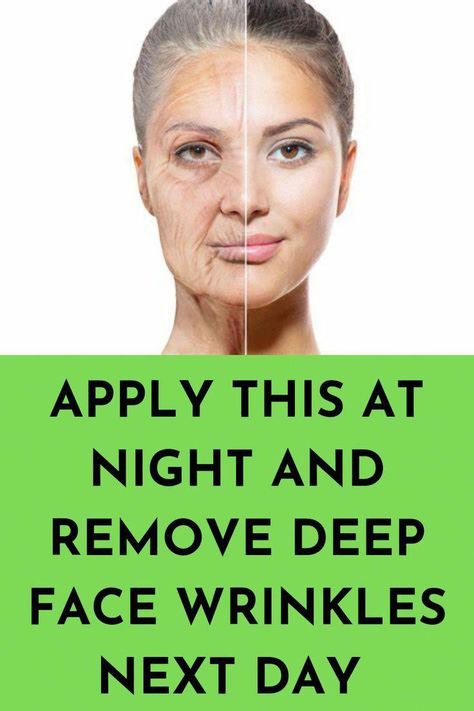 Home Remedies For Wrinkles, Anti Aging Remedies, Homemade Wrinkle Cream, Eye Wrinkles, Wrinkle Remedies, Wrinkle Free Skin, Glow Skin, Natural Anti Aging, Saggy Skin