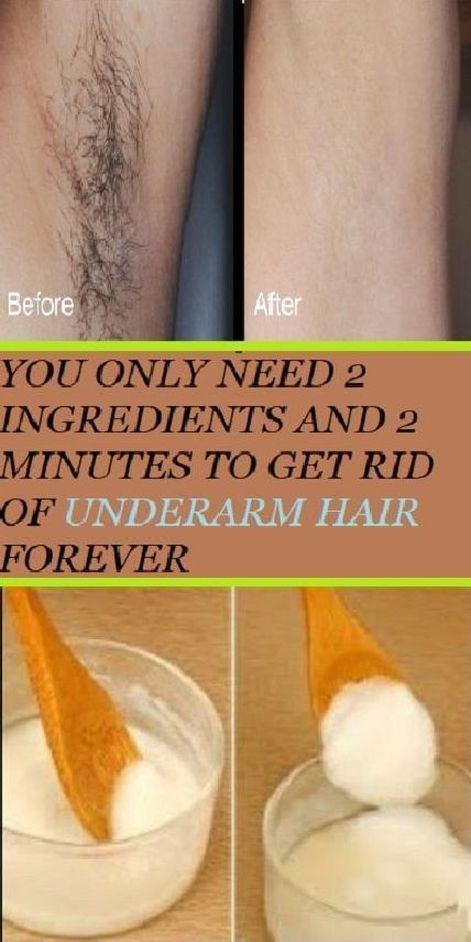 You Only Need 2 Ingredients And 2 Minutes To Get Rid Of Underarm Hair Forever To Remove Facial Hair, Hair Removal Diy, Herbal Remedies Recipes, Woman Tips, Underarm Hair Removal, Remove Unwanted Hair, Facial Hair Removal, Unwanted Hair Removal, Diy Beauty Hacks