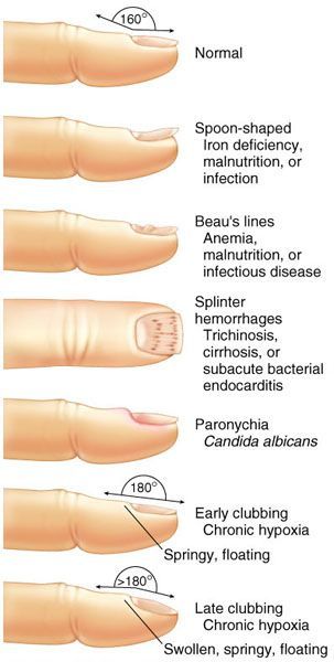 Fingernail Health, Nail Disorders, Mindset Therapy, Nail Tech School, Nail Problems, Nail Types, Nail Courses, Nail Techniques, Medical Anatomy