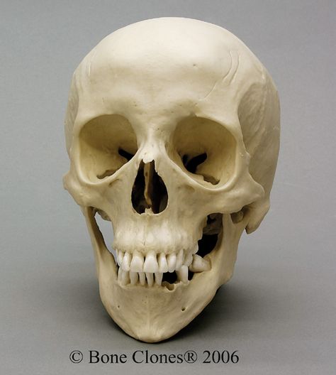 Human Female Skull with Down syndrome Anatomical Skull, Anatomy Studies, Skull Anatomy, Skull Reference, Male Figure Drawing, Skull Sculpture, Real Skull, Indian Skull, Oldest Human