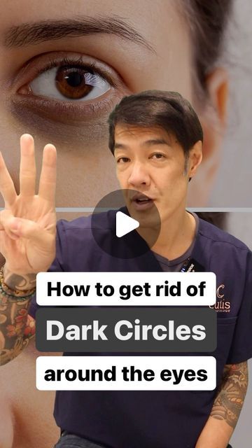 How To Rid Dark Circles Under Eyes, Dark Undereye Circles Remedies, Dark Circle Treatments, How To Get Rid Of Dark Eyelids, How To Get Rid Of Dark Circles, Get Rid Of Dark Circles Under Eyes, How To Remove Dark Circles Under Eyes, How To Cover Dark Circles, How To Get Rid Of Dark Circles Under Eye