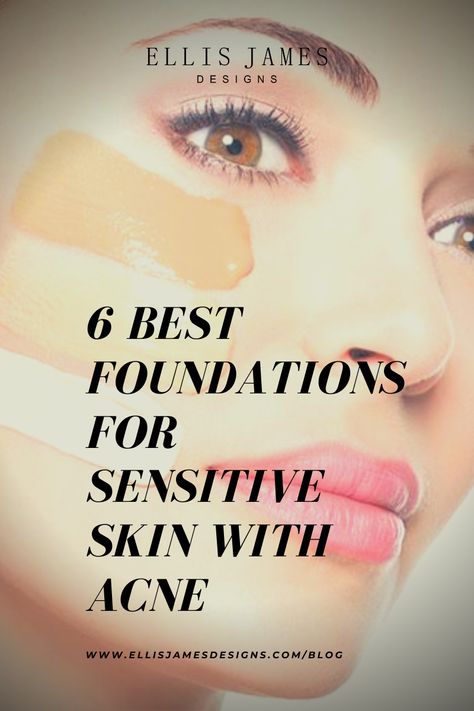 We are taking a closer look at sensitive skin with acne to learn how best to care for it and reveal the 6 best foundations for sensitive skin with acne. Read more at the Ellis James Designs Blog today! Best Foundation For Sensitive Skin, Best Foundation For Acne, Foundation For Sensitive Skin, Sensitive Acne Prone Skin, Allergy Season, Natural Makeup Tips, Acne Makeup, Best Foundations, Skin Redness