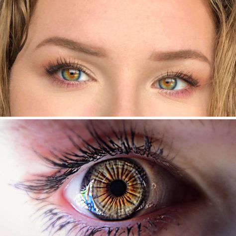 19 People Who Have Unusual Body Parts. - Wow Gallery Unusual Eye Color, Unique Features Face, Unusual Eyes, Unique Eye Color, Limbal Ring, Unique Eyes, Iris Eye, Amazing Eyes, Comic Book Superheroes