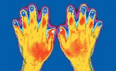 The thermogram shows the temperature of the skin surface by recording its emission of infrared radiation. Natural Hair Removal Remedies, Types Of Strokes, Infrared Radiation, Yoga Information, Loss Of Balance, Improve Nutrition, Holistic Diet, Holistic Health Remedies, Dark Underarms