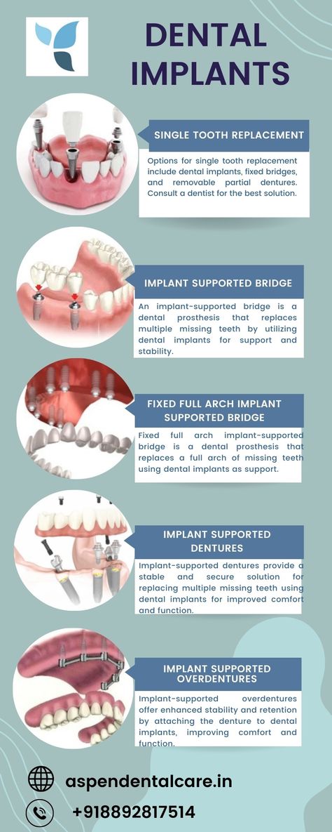 Experience the best dental implants at our trusted clinic Aspen Dental Care. Our skilled dentists provide top-notch dental implant services for a confident smile. Contact us for exceptional care and the best dental implants available. Dental Implant Poster, Dental Posters For Clinic, Dental Graphics, Dental Infographics, Dental Scaling, Dentistry Quotes, Implant Dental, Artificial Teeth, Dental Poster