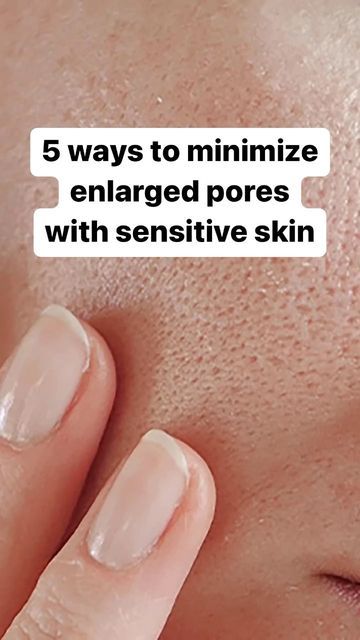 Sebum Removal Clogged Pores, Large Pores On Nose, Poreless Skin, Lotion For Oily Skin, Nose Pores, Face Pores, Smaller Pores, Reduce Pores, Essential Oils For Skin