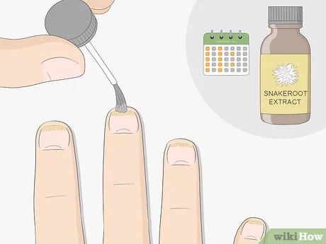 3 Ways to Get Rid of Nail Fungus - wikiHow Artery Cleanse, Sunburn Peeling, Toenail Fungal Infection, Nail Remedies, Fingernail Fungus, Red Hair Trends, Nail Fungus Remedy, Nail Infection, Fungal Nail