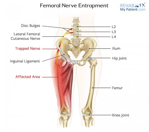 Nerves In Leg, Trapped Nerve, Hip Anatomy, Sciatic Nerve Stretches, Femoral Nerve, Nerve Anatomy, Sensory Nerves, Bolesti Chrbta, Piriformis Syndrome