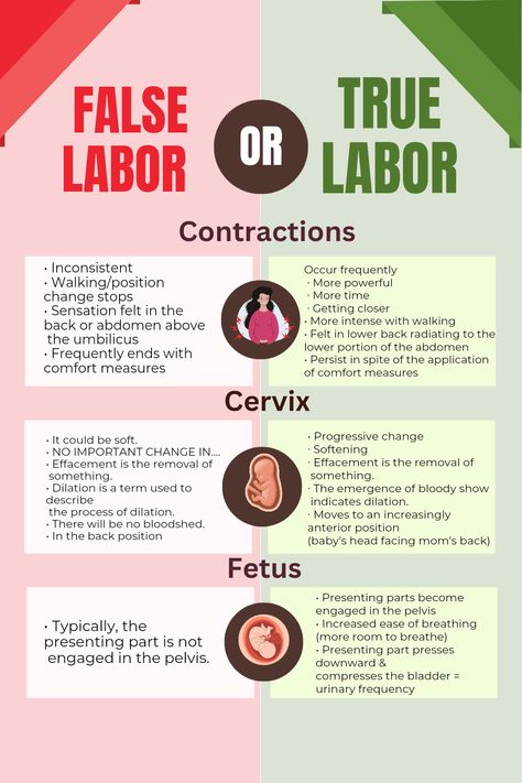 Understanding False vs True Labor: What You Need to Know Stages Of Labor Nursing Notes, Midwifery Nursing Notes, Nursing School Labor And Delivery, Labor And Delivery Nursing School Notes, Obgyn Study Notes, Labor And Delivery Notes, Labor And Delivery Cheat Sheets, Obstetrics Nursing Notes, Midwife Study Notes