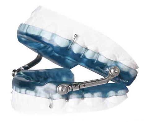 If your children or you are having a habbit of grinding teeth during night, then contact us to get perfect mouthguard according to your mouth comfortability. We can help you with female mouth guard, children mouth guard, athletes mouth guards and many more. Contact today! Mouth Guards, Orthodontic Appliances, Teeth Grinding, Dental Technician, Head Pain, Orthodontics Braces, Dental Bridge, Dental Crowns, Grinding Teeth