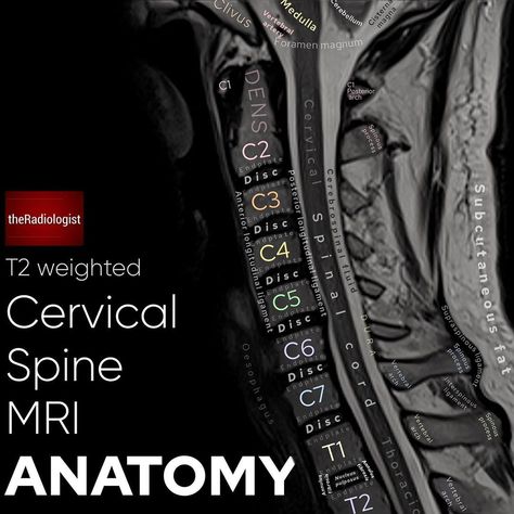 Cervical Spine Anatomy, Mri Anatomy, Spine Anatomy, Vertebral Artery, Radiology Student, Physical Therapy Student, Radiology Imaging, Nursing Student Tips, Medical Student Study