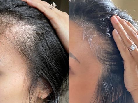 oh hey mama hair before and after Hair Before And After, Hair Regrowth Tips, Pregnancy Hair, Sugar Bear Hair, Mama Hair, My First Baby, Increase Hair Growth, Hair Growth Cycle, Hey Mama