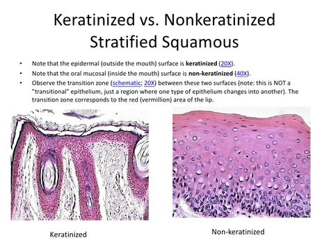 Keratinized vs. Nonkerantinized Stratified Squamous Connective Tissue Notes, Anatomy And Physiology Tissues, Squamous Epithelium, Meristematic Tissue Diagram, Stratified Squamous Epithelium, Anticholinergic Vs Cholinergic Nursing, Subcutaneous Tissue, Nursing School Notes, School Notes