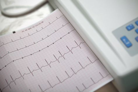 Normal Sinus Rhythm, Congenital Heart Defect, Heart Defect, Heart Palpitations, Atrial Fibrillation, Heart Rhythms, Lung Disease, Best Hospitals, Shortness Of Breath