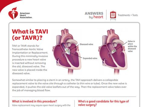 Aortic Valve Replacement, Heart Valve, Heart Valves, Symptom Tracker, Heart And Lungs, American Heart Association, Cardiovascular System, New Heart, Medical Information