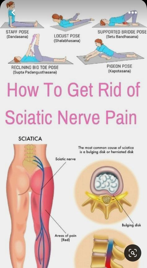 Sciatic Pain Relief, Sciatic Nerve Pain Relief, Bolesti Chrbta, Sciatica Exercises, Sciatica Pain Relief, Nerve Pain Relief, Sciatic Nerve Pain, Knee Pain Relief, Sciatica Pain