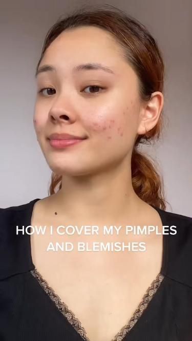 Cover pimple/blemishes with makeup routine How To Cover Pimples, Cover Pimples, Cover Up Pimples, Acne Concealer, Beauty And Cosmetics, Light Makeup Looks, Makeup Artist Tips, Good Skin Tips, Easy Makeup Tutorial