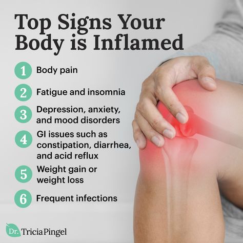 If you've ever been concerned about chronic inflammation, you've likely had two questions: 1) What causes inflammation in the body? 2) What are the top signs of inflammation? Take a look at this graphic to see if you have any of the signs of chronic inflammation and then check out my new article to learn more about what causes the inflammation in the first place. Inflammation Diet Recipes, Inflammation Remedies, Gastric Problem, Gut Inflammation, Signs Of Inflammation, Body Inflammation, Anti Inflammation Recipes, Inflammation Diet, Crystal Makeup