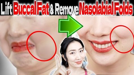 Sagging Cheeks, Facial Exercise, Tighten Skin, Nasolabial Folds, Face Exercises, Workout Diet, Facial Exercises, Fat Removal, Face Yoga