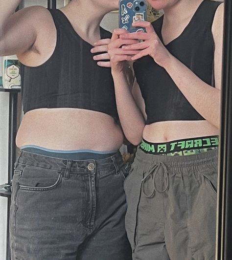 Transmasc Aesthetic Outfit, Top Surgery Outfits, T4t Couple Art, Trans Mlm Art, Transmasc Swimwear, Transguy Aesthetic, Trans Mlm Aesthetic, Underside Dyed Hair, T4t Couple Mlm Art