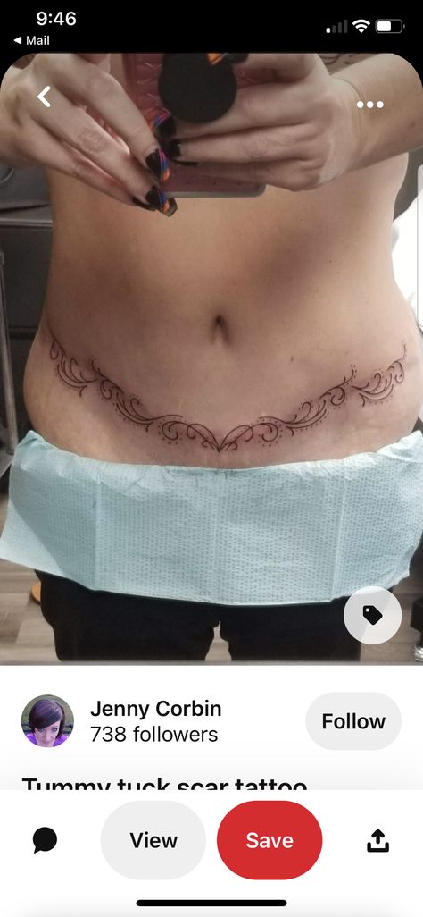 Tummy Tucks Tattoo Cover Up, C Section Scar Tattoo, Fake Scar, Mastectomy Scar Tattoo, Mastectomy Scars, Scar Makeup, Tattoos To Cover Scars, Scar Tattoo, Mommy Makeover