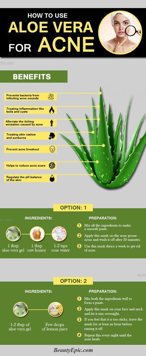 How To Use Aloe Vera For Acne Aloe Vera For Acne, Pimples Overnight, Acne Help, Natural Acne, Natural Healing Remedies, Acne Remedies, Natural Therapy, Remove Acne, Prevent Acne