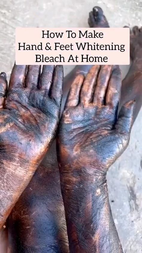 how to make HAND and FEET WHITENING BLEACH at home... Feet Whitening, Skin Care Pictures, Skin Face Mask, Clear Healthy Skin, Natural Skin Care Remedies, Diy Skin Care Routine, Shaggy Haircuts, Natural Face Skin Care, Basic Skin Care Routine