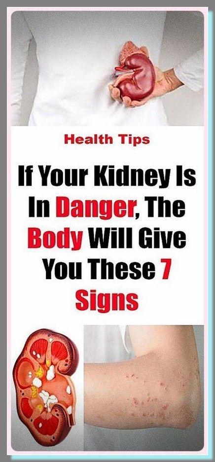 If Your Kidney Is in Danger, the Body Will Give You These 7 Signs! Kidney Damage, Kidney Health, What Happened To You, Healthy Tips, Holistic Health, Healthy Habits, Home Remedies, Baking Soda, Healthy Life