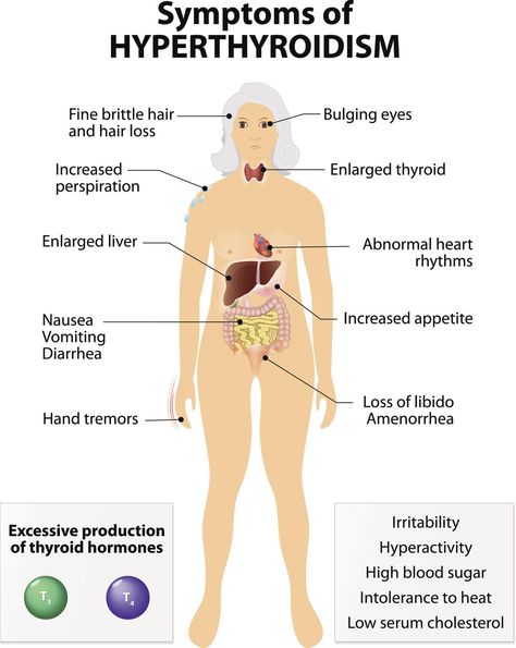 Low Thyroid Remedies, Enlarged Thyroid, Enlarged Liver, Thyroid Remedies, Overactive Thyroid, Low Thyroid, Thyroid Symptoms, Graves Disease, Thyroid Gland