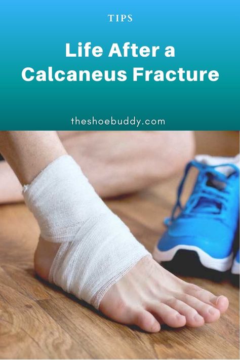 Workouts After Ankle Surgery, Tibial Plateau Fracture Exercises, Calcaneus Fracture, Ankle Fracture Recovery, Fractured Leg Broken Foot, Humerus Fracture, Avulsion Fracture, Recovery Exercises, Ankle Fracture