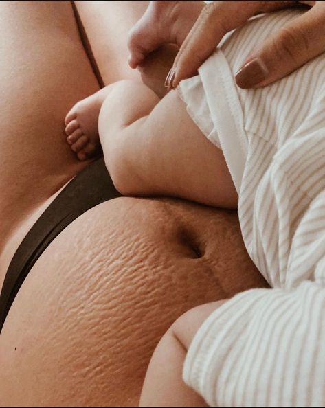 Belly After Baby, Motherhood Photos, Pregnancy Skincare, Stretch Mark Cream, Against The Grain, Postpartum Body, Skin To Skin, I Don't Always, Baby Skin Care