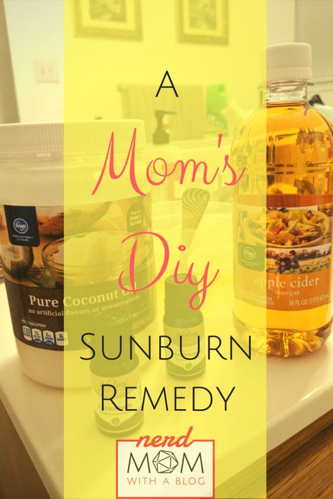 A Mom’s DIY Sunburn Remedy – Nerd Mom with a Blog Sun Burn Remedy, Baby Sunburn, Sunburn Remedy, Burn Remedy, Diy Apple Cider, Sunburn Peeling, Sunburn Remedies, Sun Burn, Aloe Gel