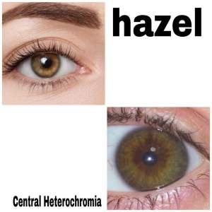 Central Heterochromia, Heterochromia Eyes, Hazel Green Eyes, Hazel Green, Gorgeous Eyes, Hazel Eyes, High Frequency, Do You Really, Pretty Eyes