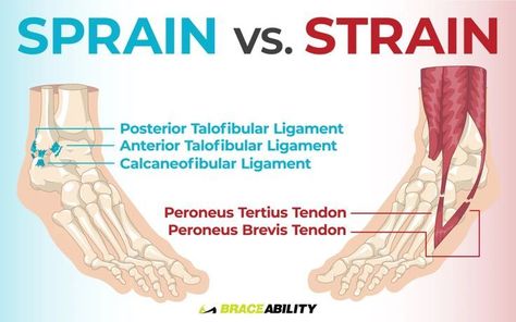 The terms ‘twisted ankle‘rolled ankleand ‘sprained anklecan all basically be used to describe the same thingThe outcome is the samebut the way you got the injury may differLearn more about how to treat your sprained ankle and what you can do the prevent the injury from reoccurring How To Wrap Ankle Sprain, Wrapping A Sprained Ankle, Sprain Ankle Remedies, Wrapping Ankle Injury, Ankle Injury Workout, Ankle Sprain Pictures, How To Wrap An Ankle, Ankle Strengthening Exercises Sprain, Ankle Sprain Exercises