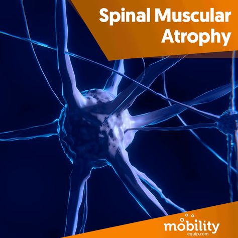 Click the link and learn more about it. https://www.mobilityequip.com/blog/spinal-muscular-atrophy/ Spinal Muscular Atrophy, Motor Neuron, Genetic Diseases, Genetic, Click The Link, Disease, Movie Posters, Film Posters