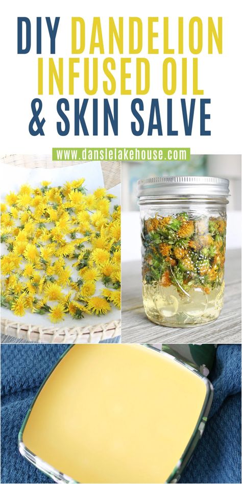 Dandelion Infused Oil, Flower Infused Oil, Diy Dandelion, Dandelion Salve, Dandelion Oil, Lip Salve, Salve Recipes, Medical Herbs, Herbal Salves