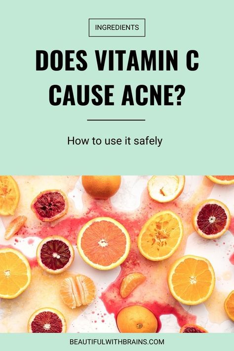 Does Vitamin cause acne or treat it? Here's how to use it safely if you have oily, acne-prone skin that easily breaks out. Vitamin C Serum For Acne Prone Skin, Cetaphil Acne, Anti Acne Skin Care, Acne Prone Skin Care Routine, Forehead Acne, Acne Prone Skin Care, Best Vitamin C Serum, Skin Facts, Best Vitamin C