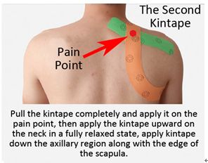 Shoulder Kinesio Taping, Shoulder Kt Taping, Back Taping, How To Tape Shoulder For Pain, Kt Tape Neck And Shoulder Pain, Kinesiology Taping Shoulder, Kt Tape Shoulder, Physio Tape, K Tape