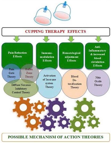 The usual effects of cupping therapy. Wet Cupping, Silicone Cupping, Massage Cupping, Control Theory, Cupping Massage, Aging Backwards, Systems Theory, Cupping Therapy, Immune Response