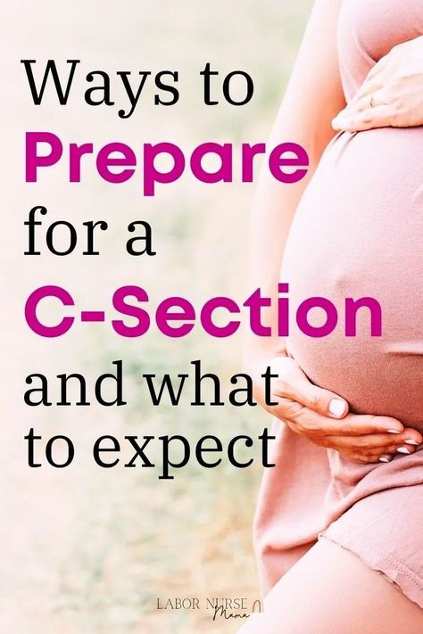 Ways you can be prepared for a C-Section and exactly what to expect from your surgery. The ultimate cesarian guide. C Section Preparation, Prepare For C Section, Labor Exercises, Labor Stages, Birth Advice, Tips For Pregnancy, Birth Tips, Stages Of Labor, Labor Nurse