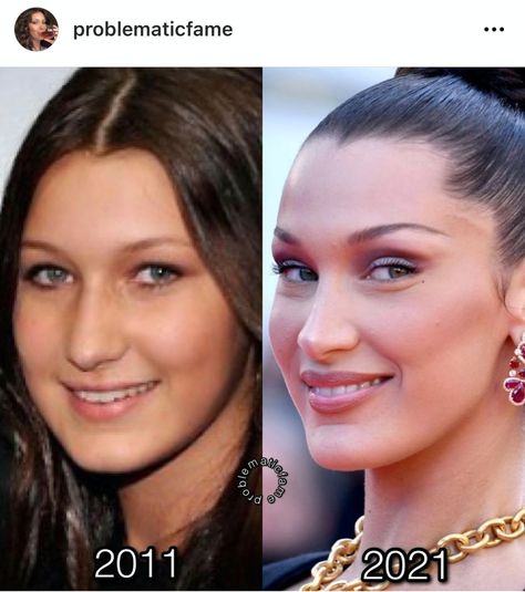 Bella Hadid's Old Nose - by Jessica DeFino Gigi Hadid Nose, Bella Hadid Nose, Yolanda Hadid, Perfect Nose, Nose Surgery, Under The Knife, Nose Job, Beauty Standards, Body Modifications