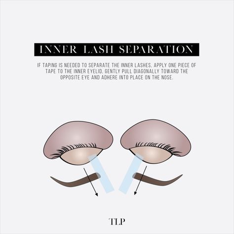 Lash taping tips! ✨🤩 These taping methods can help your lashing immensely! These literally become a lifesaver. 🙌🏻 Taping back the eyelid can help expose those hard-to-reach natural lashes! Also, taping back layers of lashes helps speed up the lashing process! ⏰👏🏻

💬 Comment below if you use any of these taping methods! 

#lashtips #lashextensions #lashtech #lashartist #lashtip Taping Method Lashes, Eyelash Education, Lash Layers, Lash Extension Taping Techniques, Eyelash Extension Process, Lash Extension Course, Lash Extension Retention Tips, Lash Education, Lash Posts